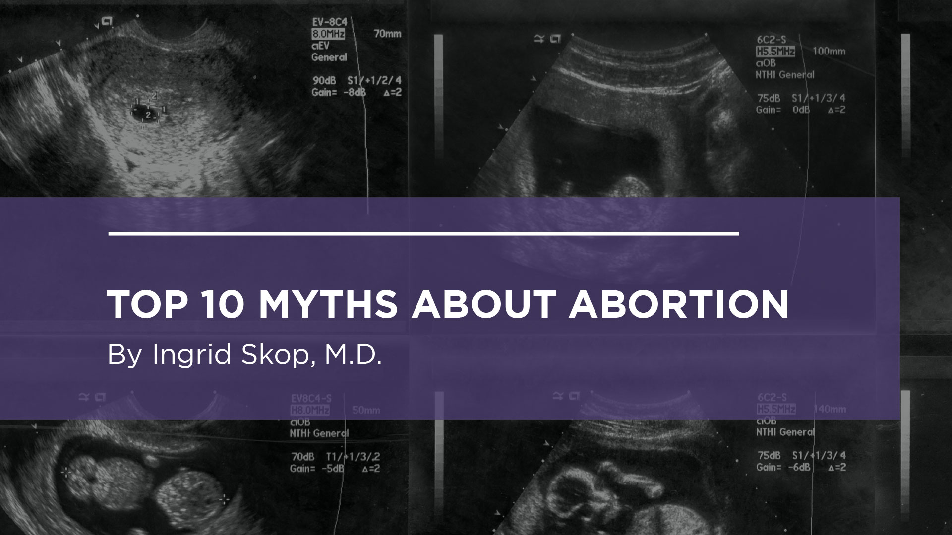 Top 10 Myths About Abortion